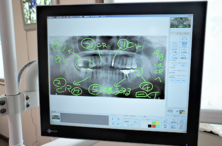 ソフトビジュアルマックス